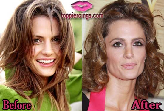 How Well Does Stana Katic Nose Job Look? 