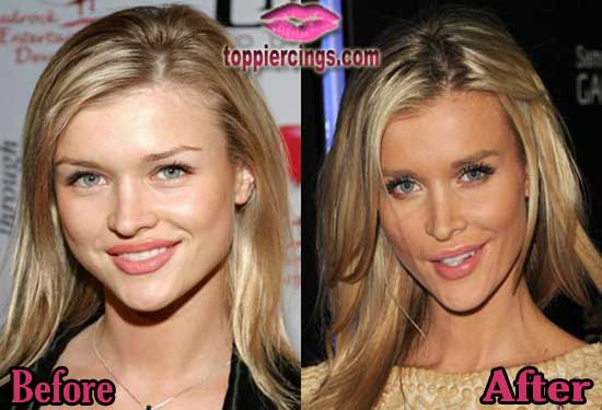 Joanna Krupa Plastic Surgery Before and After Pictures ...