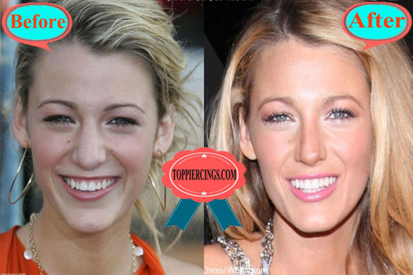 Blake Lively Nose Job Before And After Top Piercings