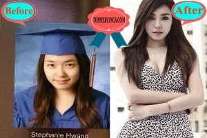 surgery plastic hwang stephanie before after please ebay