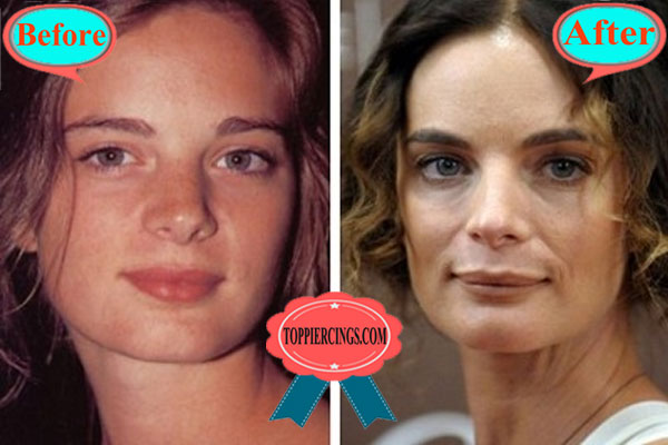 Gabrielle Anwar Plastic Surgery Before and After.