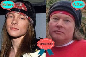 Axl Rose Plastic Surgery Before And After Pictures Top Piercings