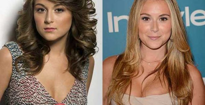 alexa penavega plastic surgery before and after