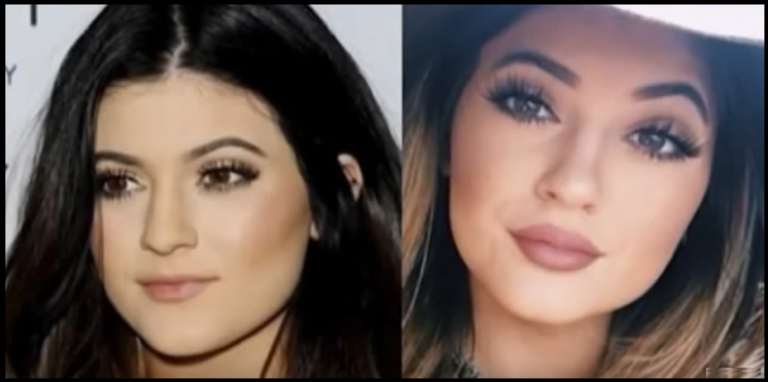 Kylie Jenner Plastic Surgery Transformations | Top Piercings