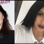 Kylie Jenner Lip Fillers Plastic Surgery